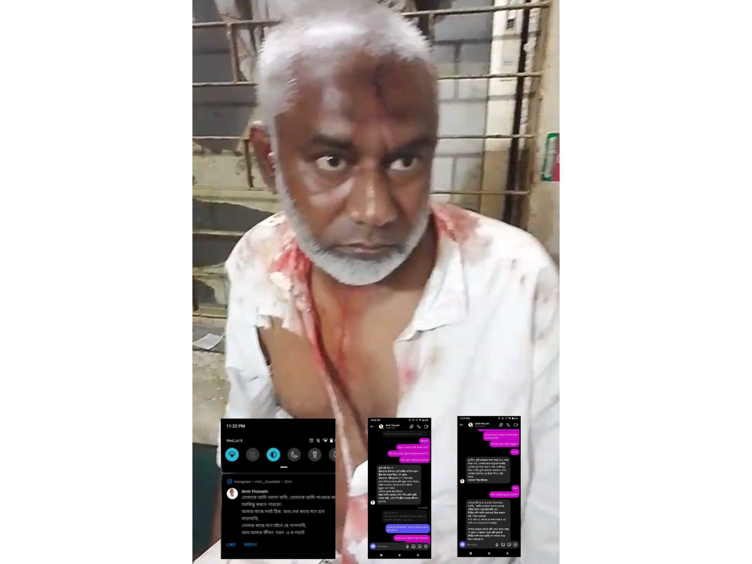 ​ফতুল্লার কুতুবপুরে স্কুলছাত্রীকে উত্ত্যক্ত করায় একজনকে গণধোলাই থানায় পাল্টাপাল্টি অভিযোগ আহত -২