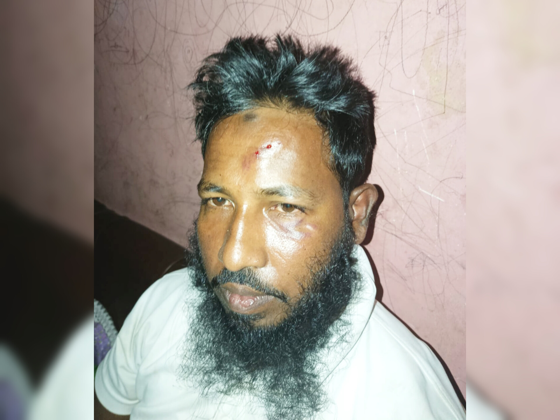 কুতুবপুর ইউনিয়ন ৬নং ওয়ার্ড জামায়াত সেক্রেটারির ওপর সন্ত্রাসী হামলার অভিযোগ, থানায় মামলা